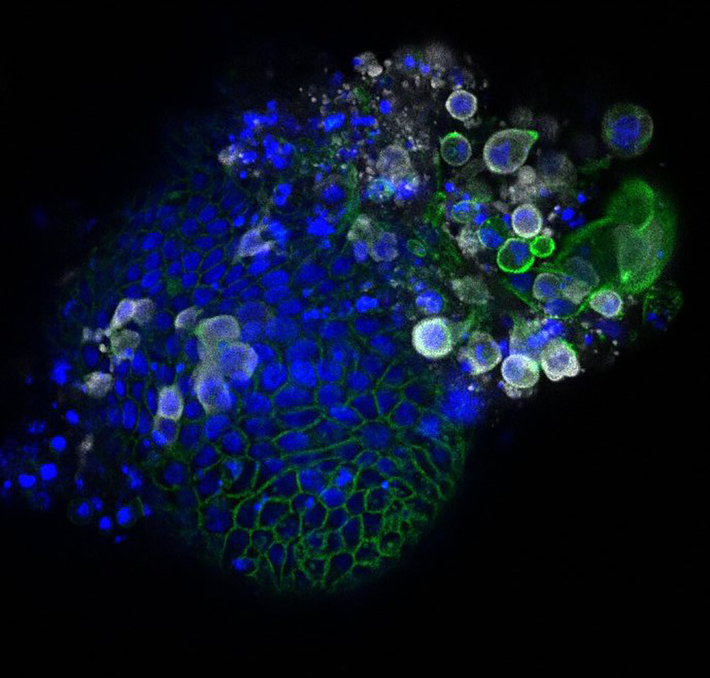 الكشف عن الصور التفصيلية الأولى لفيروس كورونا تظهر كيف يتكاثر في الأمعاء